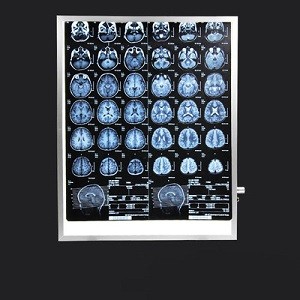 X-ray Film Viewer