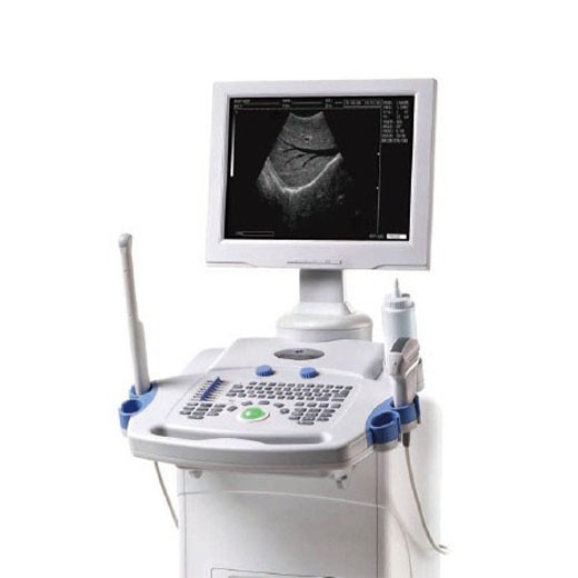 Digital Portable Ultrasound Scanner (80 Element)